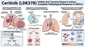 Ceritinib (LDK378) Inhibits ALK Tyrosine Kinase to Induce Complete Pathological Response in NSCLC
